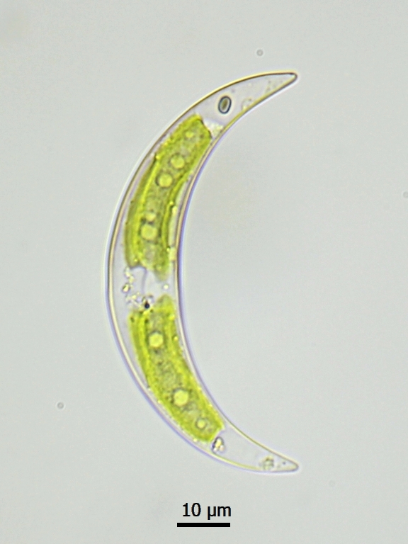 Closterium incurvum